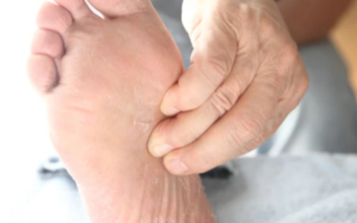 وش اسوي : قدم الرياضي