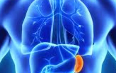 وش اسوي : داء غوشيه