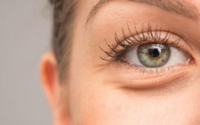 أسباب انتفاخ تحت العينين