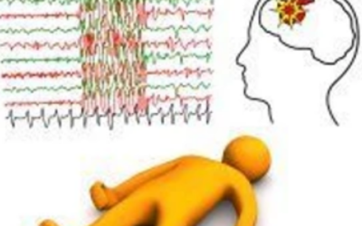 وش اسوي : علاج الصرع