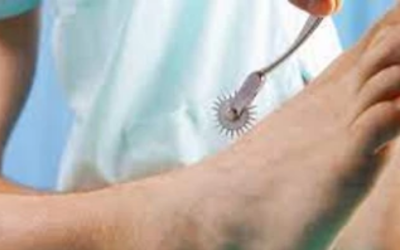 وش أسوي: التهاب الأعصاب في الأرجل: أسباب وعلاج