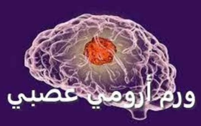 وش اسوي : ورم أرومي عصبي