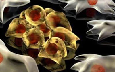 وش اسوي : السرطان