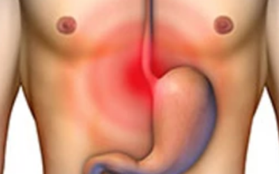 وش اسوي : عسر الهضم