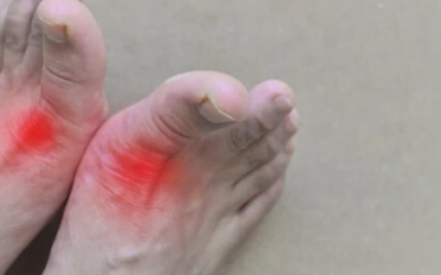 وش أسوي: داء الملوك