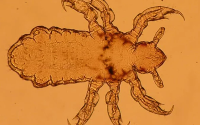 أكثر 10 حشرات مزعجة في العالم