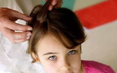 وش اسوي : كيفية التخلص من حشرات الشعر