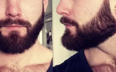 وش اسوي : طرق سريعة لإطالة وتكثيف الذقن