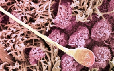 وش اسوي : أسباب نزول الدم مع المنى