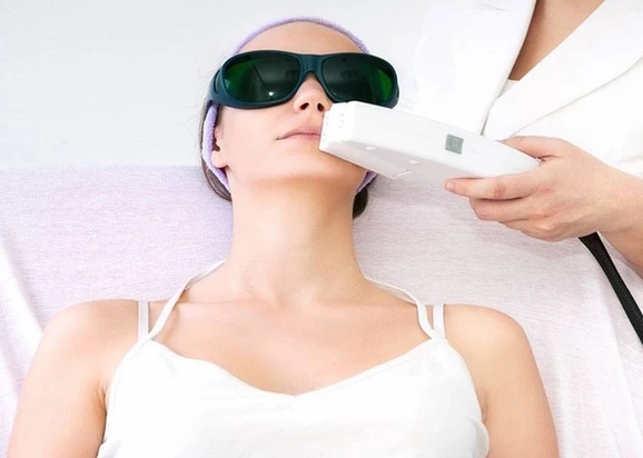 وش أسوي: إزالة الشعر بالليزر