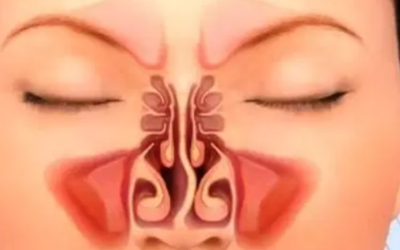 وش أسوي: انحراف الحاجز