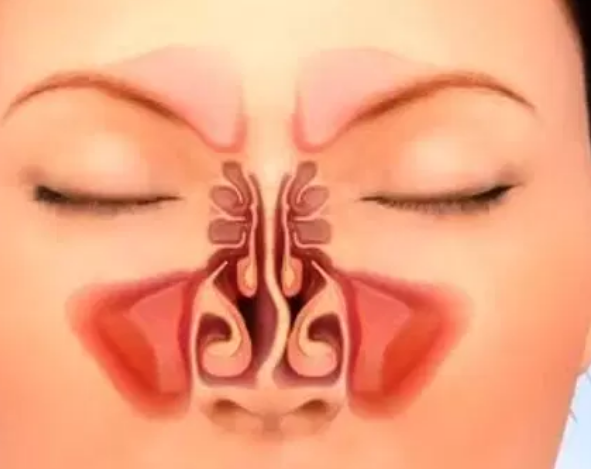 وش أسوي: انحراف الحاجز