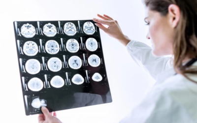 وش أسوي: نقائل الدماغ