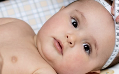 وش أسوي: صغر الرأس