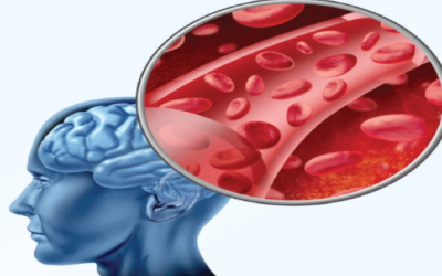 وش أسوي: إعادة تأهيل الدماغ