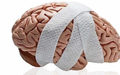 وش أسوي: إصابات الدماغ الرضحية