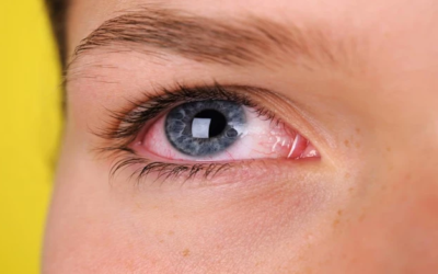 وش أسوي: الإسعافات الأولية لدخول جسم غريب في العين