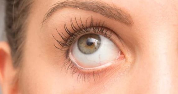 وش أسوي: أسباب وأعراض العيون الجافة