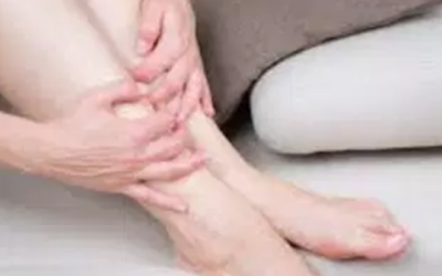 وش اسوي : مرض الحمامي العقدة – Erythema nodosum