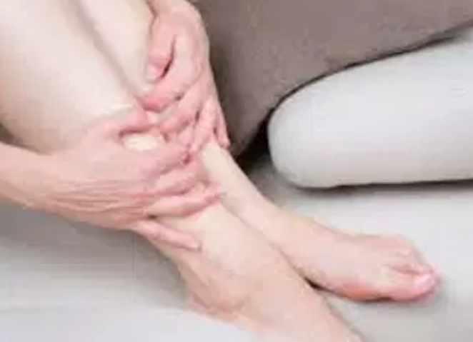 وش اسوي : مرض الحمامي العقدة – Erythema nodosum