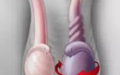 وش اسوي : علاج ألم الخصية