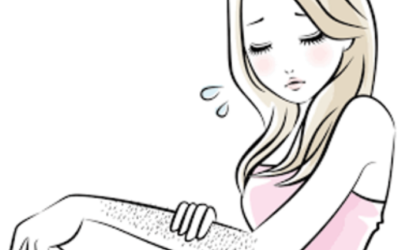 وش اسوي : الشعر الزائد لدى النساء – Hirsutism