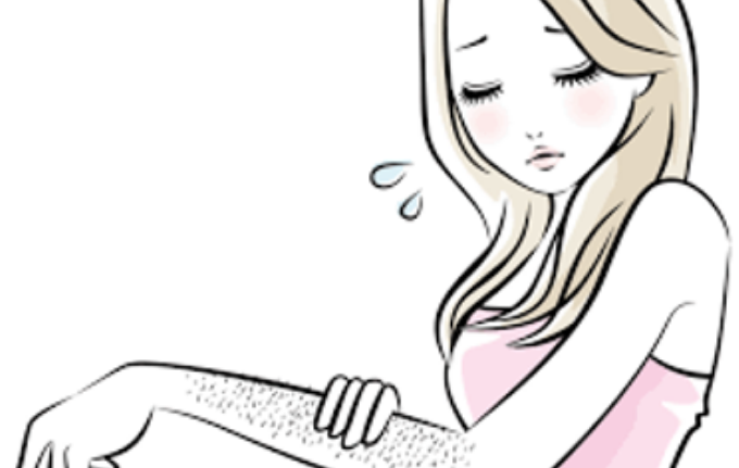 وش اسوي : الشعر الزائد لدى النساء – Hirsutism