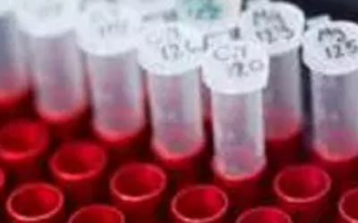 وش اسوي : الورم الحبيبي اللمفي المنقول جنسياً