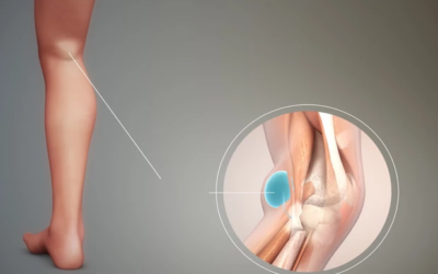 وش أسوي: كيسة بيكر