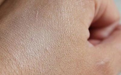 وش اسوي : طبقه الجلد التي تعمل على عزل الجسم هي ؟