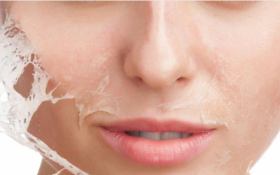 وش اسوي : إزالة الرؤوس السوداء بالجيلاتين