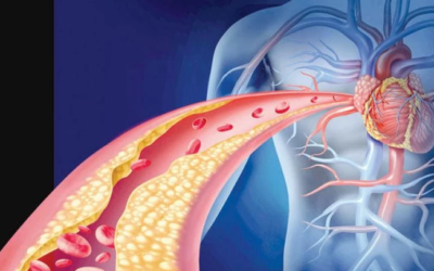 وش أسوي: فرط كوليسترول الدم العائلي
