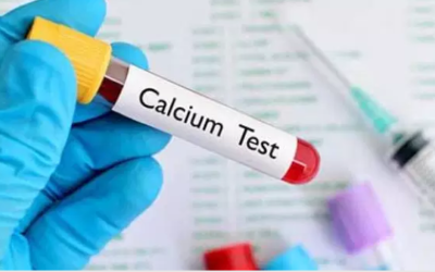 وش أسوي: فرط كالسيوم الدم