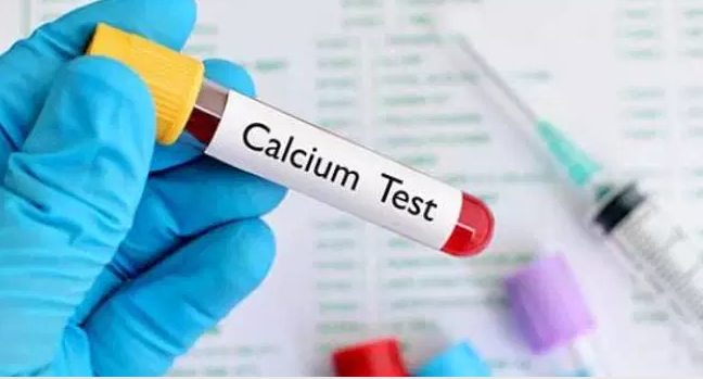 وش أسوي: فرط كالسيوم الدم