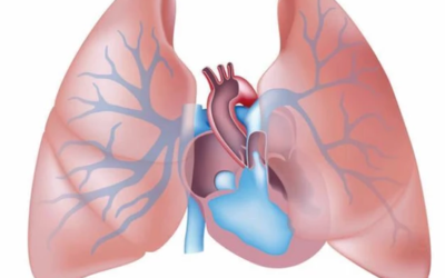 وش أسوي: فرط ضغط الدم الرئوي