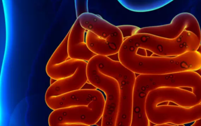 وش أسوي: فرط النمو البكتيري في الأمعاء الدقيقة (SIBO)