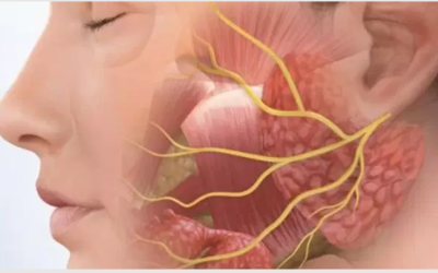 وش اسوي : علاج العصب السابع