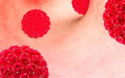 وش أسوي: فحص سرطان الفم