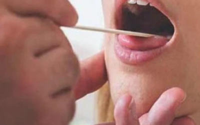 وش أسوي: سلاق الفم