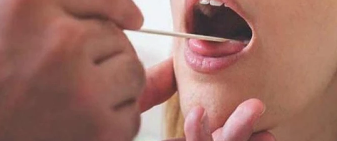 وش أسوي: سلاق الفم