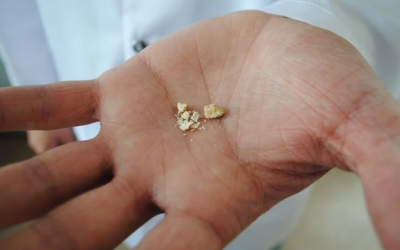 وش اسوي : 10 من أشد الآلام عند الإنسان