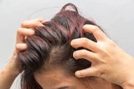 وش أسوي : تعرفي على أنواع فروة الرأس