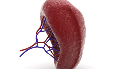 وش أسوي: تضخم الطحال