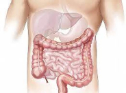 وش اسوي : التهاب القولون المجهري