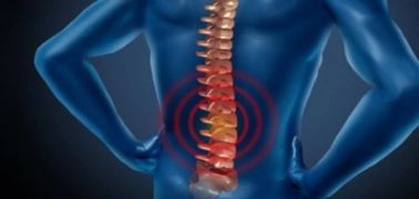 وش أسوي: الورم الفقري