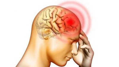 وش اسوي : السكتة الدماغية