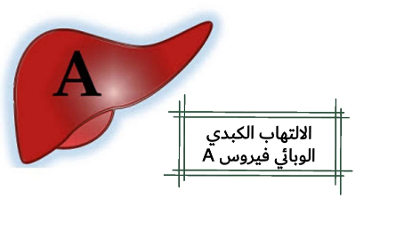 وش أسوي: التهاب الكبد A