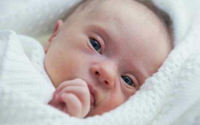 أعراض متلازمة كروزون