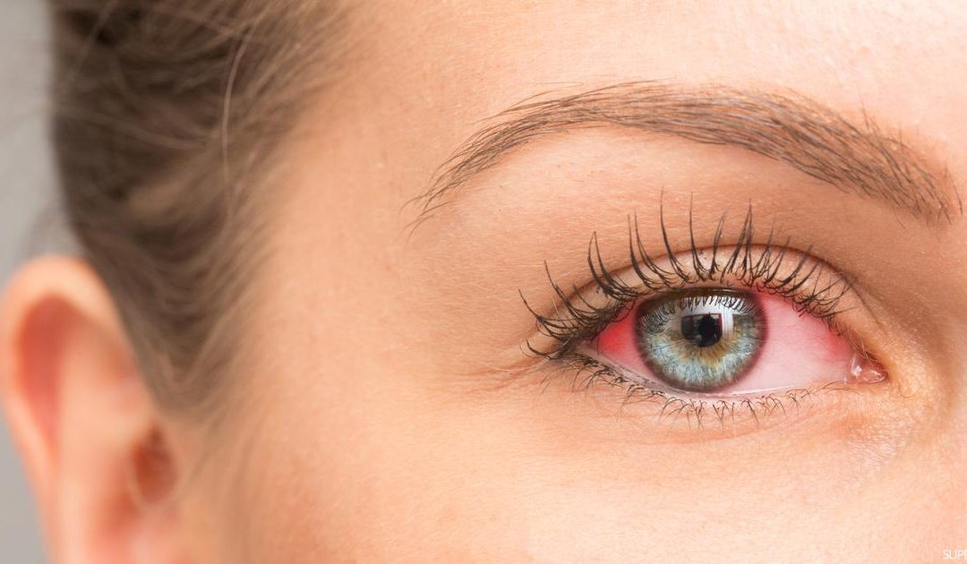 متلازمة شوغرن