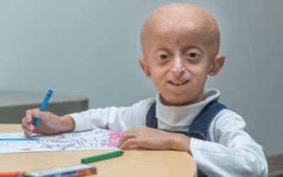 ما هي الشيخوخة المبكرة عند الأطفال